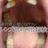 Orthodontics in Ryoko oral Rimming lens waterproof camera sneaks and real