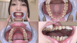 【歯フェチ】桐谷なおちゃんの歯を観察しました！