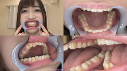 [牙神物]我觀察了Manami Oura的牙齒！