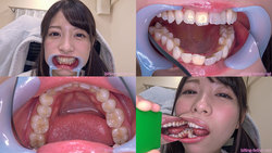 【歯フェチ】あおいれなちゃんの歯を観察しました！