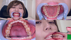 [牙齒拜物教]我觀察了Haruka Haru的牙齒！