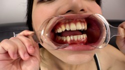 【歯フェチ】プチ口内観察かずみの口の中